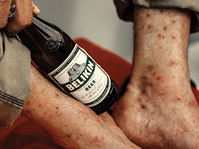 Using cold beer to bring down swelling